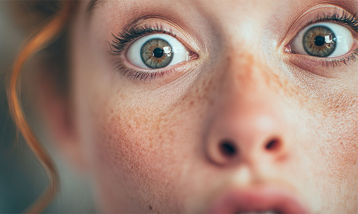 Červené pehy na koži: Prečo vznikajú a ako s nimi zaobchádzať