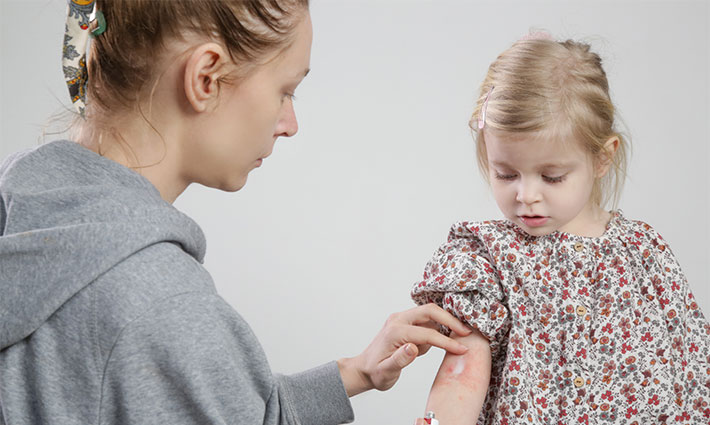 Atopický ekzém u detí: Ako upokojiť citlivú pokožku