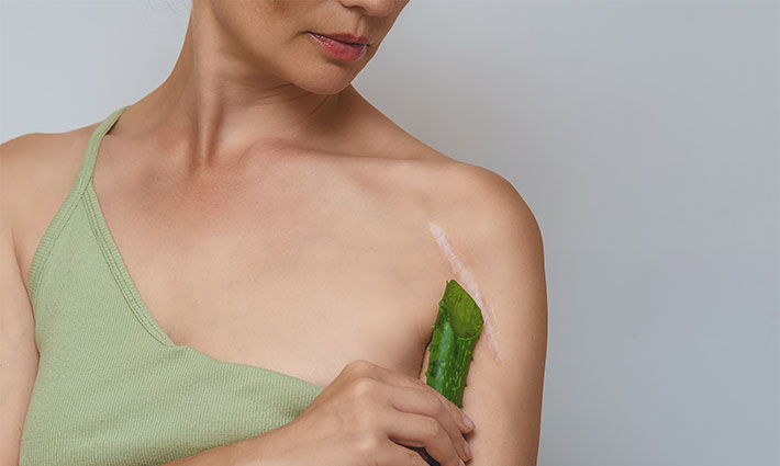 Ako sa starať o jazvy, aby sa správne zahojili