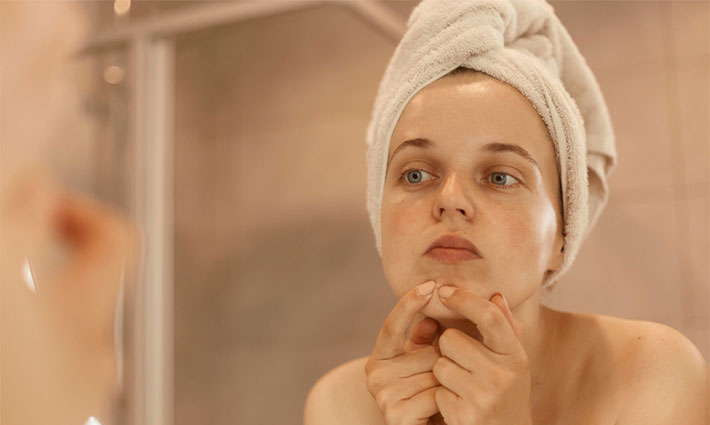 Ako vznikajú upchané póry a čo s nimi?