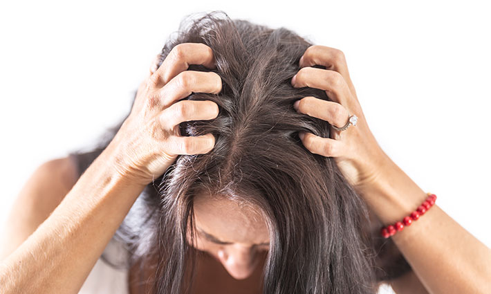 Čo na suchú pokožku hlavy: Príčiny svrbenia a ako na účinnú hydratáciu