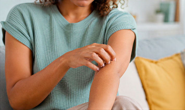 Atopický ekzém neovplyvňuje len kožu. Zasahuje aj psychiku